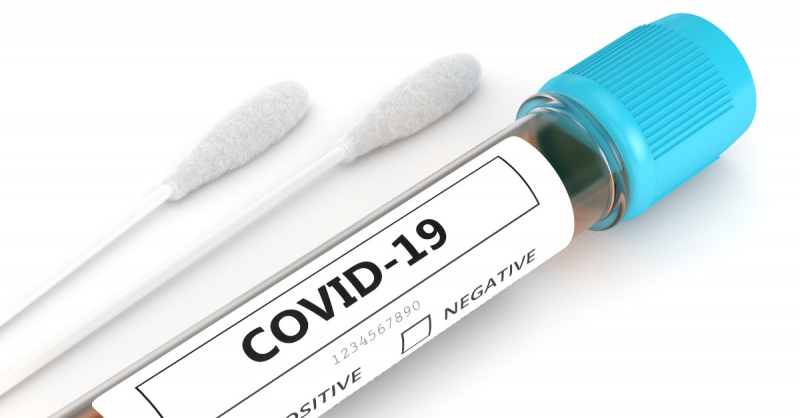 Covid-19 testu bez ārsta nosūtījuma varēs nodot līdz 6.aprīlim