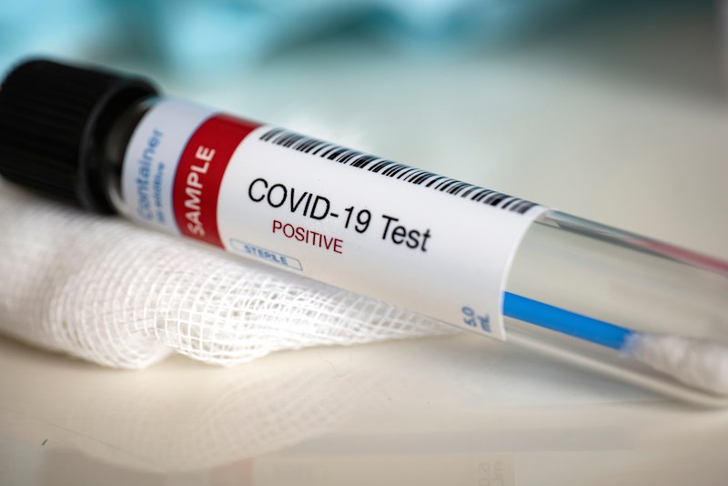 Tukuma novadā konstatēts viens ar Covid-19 inficētais