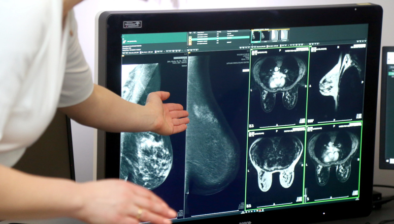 Nākamgad ārstēs pacientus, ko nevarēja šogad. Budžetā slimnīcām trūkst 20 miljonu eiro Nākamgad ārstēs pacientus, ko nevarēja šogad. Budžetā slimnīcām trūkst 20 miljonu eiro
