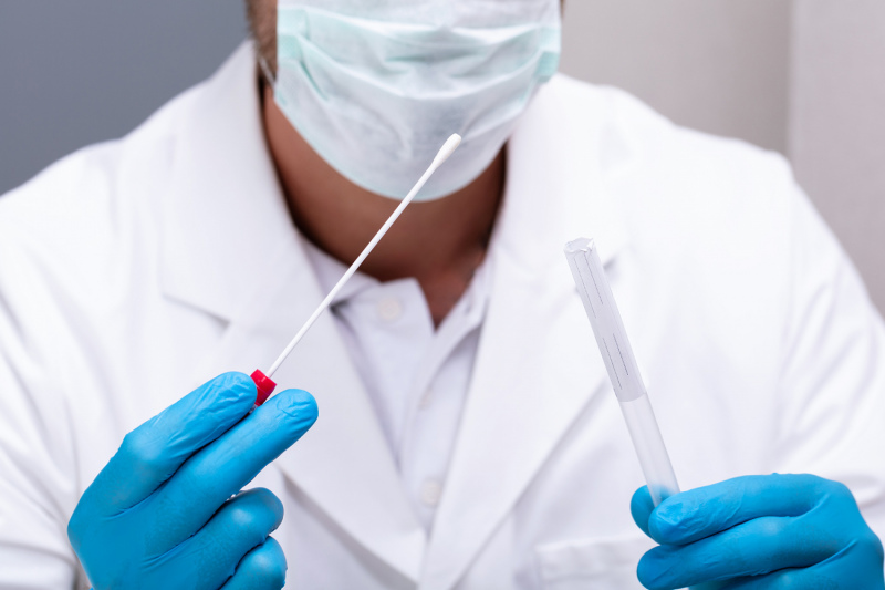 Darbinieku Covid‑19 testēšana ar ātrajiem testiem būs brīvprātīga